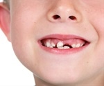 Scanning children's teeth may predict future mental health issues