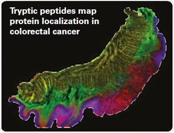 Correlate Protein Glycosylation to Disease
