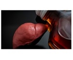Study finds identical alcohol relapse rates among liver transplant recipients regardless of sobriety period