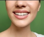 Over-the-counter teeth whitening strips damage teeth and gums, warn experts