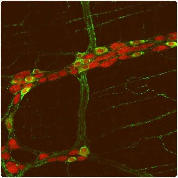 Study confirms gut-brain link in autism