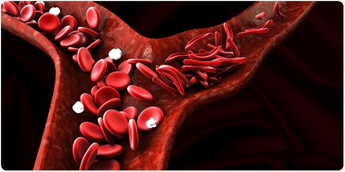 Image Credit: Victor Josan / Shutterstock