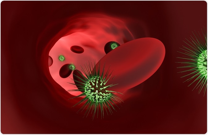 Sepsis is a life-threatening condition that occurs when microorganisms enter the bloodstream.