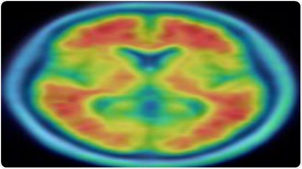 Smarter, more educated people get a cognitive