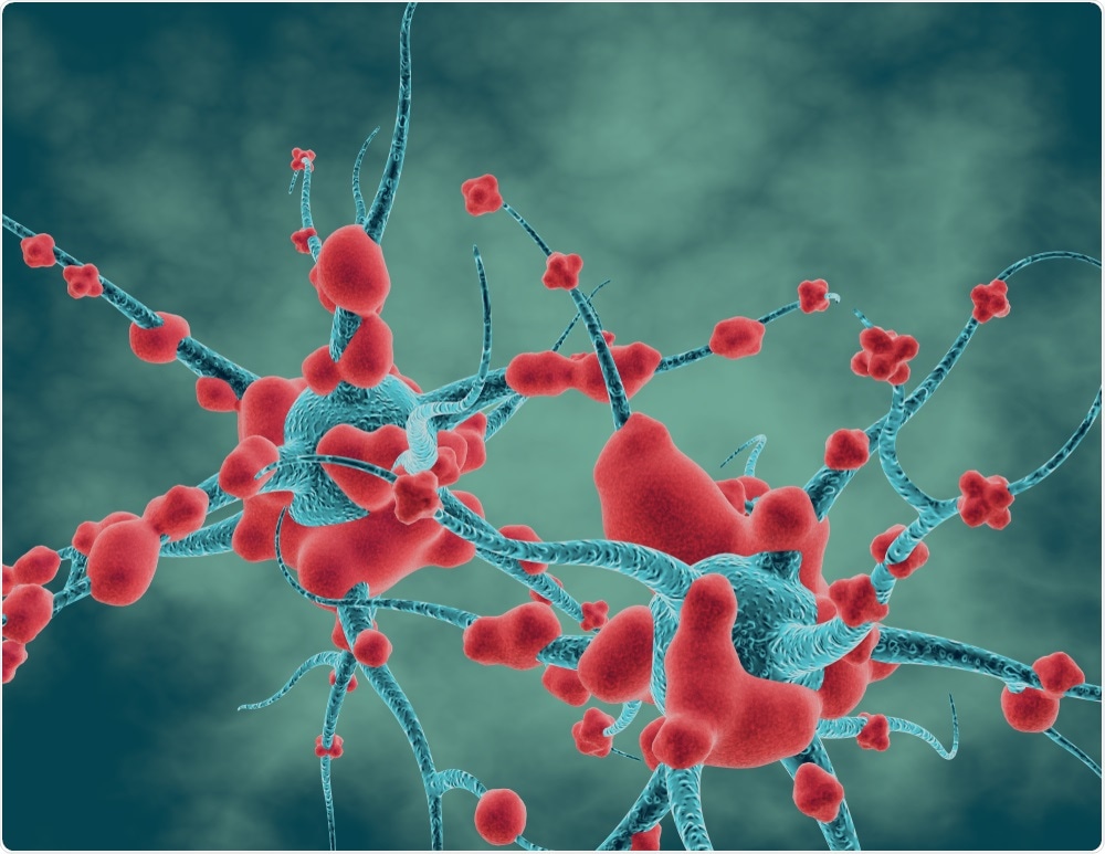 Researchers have developed three novel FACS protocols that can be used to isolate neural progenitors, astrocytes, and neurons from virus-infected cerebral organoids.