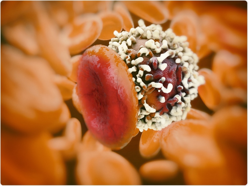 The researchers discovered several cells that are involved in the pathology of asthma.