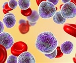 Leukemia and Childhood Infection Hypothesis