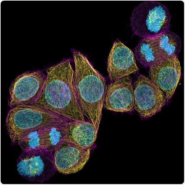New Multiplex mode for ZEISS Airyscan 2 delivers images with superresolution in less time