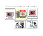 Researchers use AI to develop early gastric cancer endoscopic diagnosis system