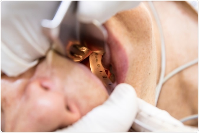 Orotracheal intubation procedure. Image Credit: Lorena Huerta / Shutterstock