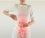 Exposure to micro- and nanoplastics linked to rising number of people with chronic IBD