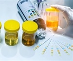 Urine Analysis / Urinalysis