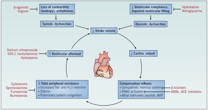 The mechanism of heart failure. Abbreviations: ACE – angiotensin-converting enzyme; ARBs – angiotensin II receptor blockers; AVP – arginine vasopressin; RAAS – reninangiotensin- aldosterone system.