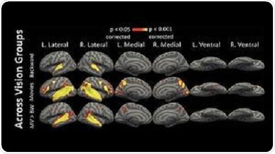 Research shows how the brain repurposes unused regions in blind people