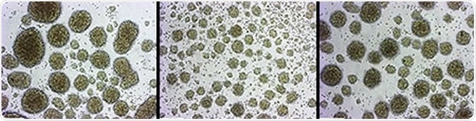 3D human brain organoids. Left: normal, uninfected. Center: infected with Zika virus. Right: infected with Zika virus and treated with cilengitide, which protects the cells from destruction by the virus. Image Credit: UC San Diego Health Sciences