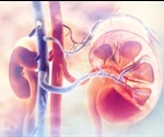 Study casts doubt on the reliability of donated kidney assessment for transplant