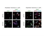 Characterization of Pancreatic Cancer Cells Response to Peptigels that Mimic Healthy and Tumor Tissue Properties