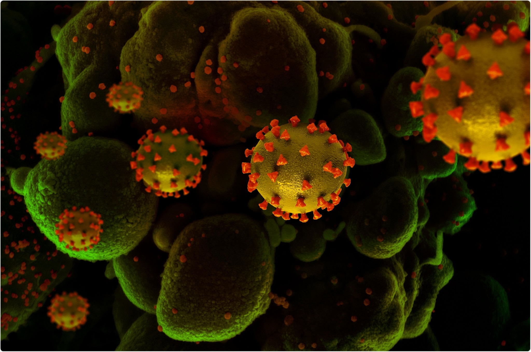 Study: Higher viral loads in asymptomatic COVID-19 patients might be the invisible part of the iceberg. Image Credit: NIH