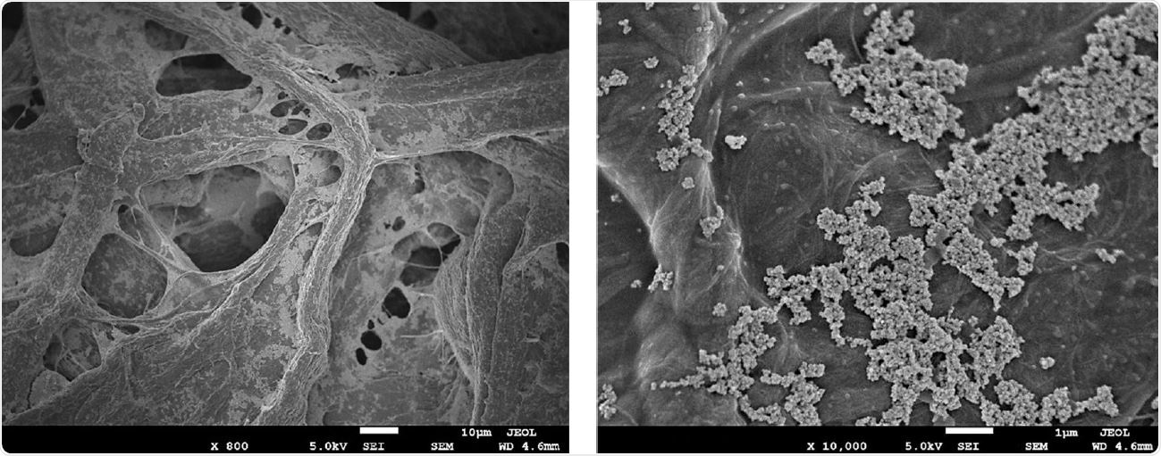 High magnification scanning electron microscopy images of aCu on 45/55 cellulose/polyester fabric. (A) fibers of the cellulose/polyester fabric coated with aCu. (B) 10,000x magnification of aCu on fabric, showing copper agglomerates in the 3-7 micrometer range.