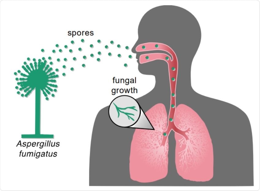 Inhalation of Aspergillus spores can result in fungal infection. Inhalation of Aspergillus spores from the environment can travel to the lung and then grow vegetatively and spread to other parts of the body.
