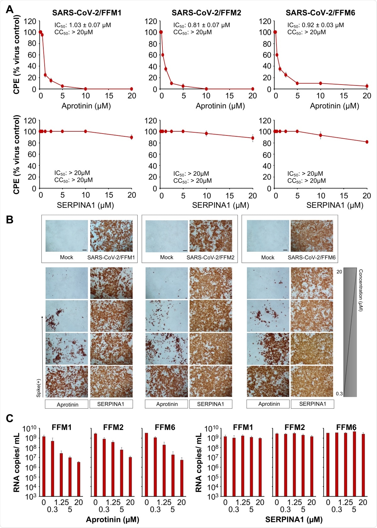 Anti-severe acute respiratory syndrome virus 2 (SARS-CoV-2) effects of aprotinin and SERPINA1/alpha-1 antitrypsin. (A) Concentration-dependent effects of aprotinin and SERPINA1/alpha-1 antitrypsin on SARS-CoV-2-induced cytopathogenic effect (CPE) formation determined 48 h post-infection in Caco2 cells infected at a multiplicity of infection (MOI) of 0.01 with the three different SARS-CoV-2 isolates. The viability of the Caco2 cells was 84.3 ± 2.7% relative to the untreated control in the presence of 20 µM of aprotinin. (B) Immunostaining for the SARS-CoV-2 S protein in aprotinin- and SERPINA1/alpha-1 antitrypsin-treated Caco2 cells infected at an MOI of 0.01 with the three different SARS-CoV-2 isolates as determined 48 h post-infection. The protease inhibitors were tested at four concentrations in 1:4 dilution steps ranging from 20 to 0.3125 µM. A quantification is provided in Figure S1. (C) Copy numbers of genomic RNA in Caco2 cells infected with different SARS-CoV-2 isolates (MOI of 0.01) in response to treatment with aprotinin or SERPINA1/alpha-1 antitrypsin as determined 48 h post-infection. FFM1, 1/Human/2020/Frankfurt; FFM2, 2/Human/2020/Frankfurt; FFM6, 6/Human/2020/Frankfurt.