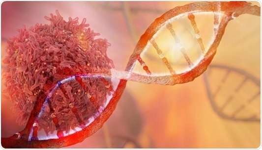 CEAT project for improving ovarian cancer diagnosis, treatment shows promise