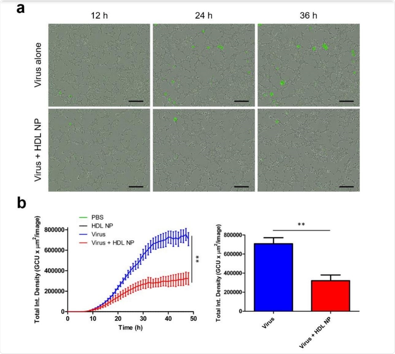 HDL NP treatment inhibits infection of SARS-CoV-2 pseudovirus in HEK293 (ACE2) cells.