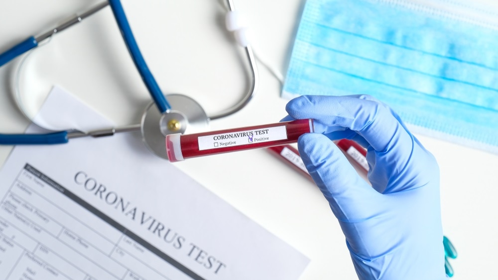 coronavirus test