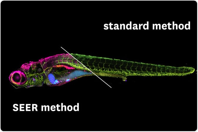 The new imaging technique is considerably faster and could even be used in a smartphone app for remote medicine or food safety. (Image/Wen Shi, Daniel E.S. Koo and Francesco Cutrale)