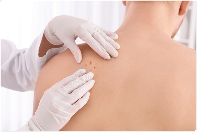 Image Credit: New Africa / Shutterstock