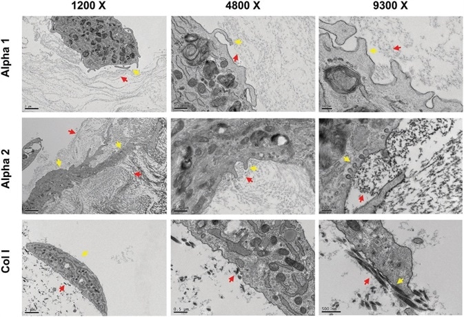 hdASC closely interact with Alpha 1 and Alpha 2 nanofibers. Transmission electron  micrograph showed that hdASC (yellow arrows) are actively interacting with the SAPs nanofibers (red arrows) with cells extending processes within the hydrogel structures. At higher magnification (9300× , right panels) it was possible to identify caveolae-like structures, which were not present in control cultures of hdASC on Col I gels (bottom row).