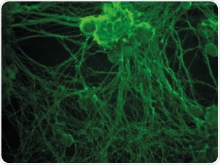 Nerve Repair by Delivering Stem Cell Therapies
