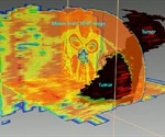 Using Spectral Imaging to Study Brain Tumors in 3D