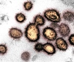 Eleventh global case of SARS-linked virus confirmed in U.K.