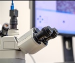 Benefits of Digital Pathology