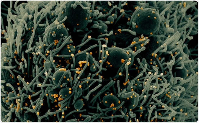 Novel Coronavirus SARS-CoV-2 - Colorized scanning electron micrograph of an apoptotic cell (green) infected with SARS-COV-2 virus particles (orange), isolated from a patient sample. Image captured at the NIAID Integrated Research Facility (IRF) in Fort Detrick, Maryland. Credit: NIAID