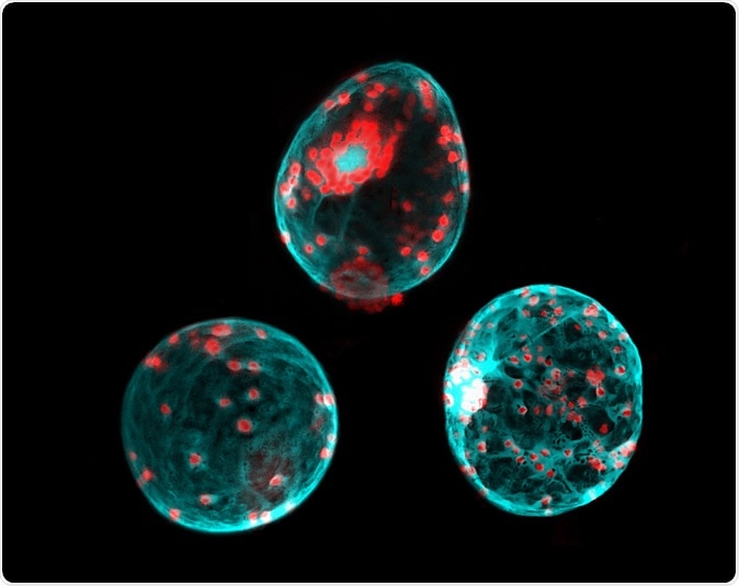 Nicotiana benthamiana leaf protoplasts expressing GFP. The cell wall was removed by treatment with enzymes (cellulase, pectinase). Image Credit: Heiti Paves / Shutterstock