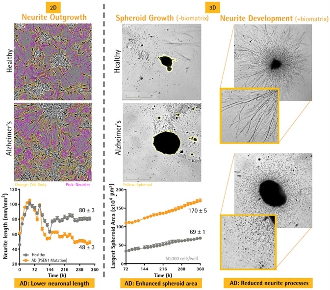 Neuronal and Microglial Analysis for Alzheimer’s Disease Models