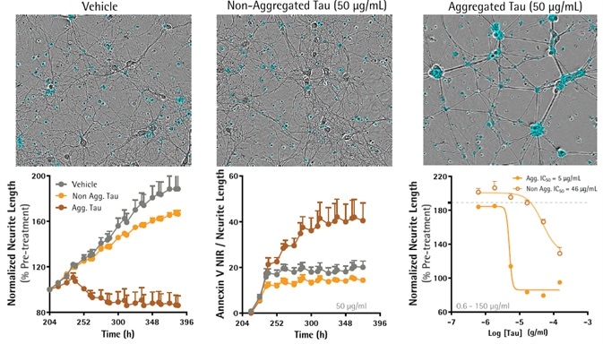 Neuronal and Microglial Analysis for Alzheimer’s Disease Models