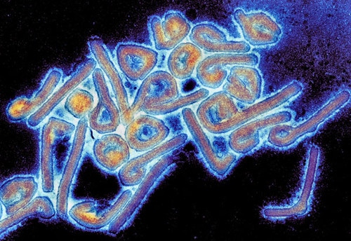 Colorized Marburg virus particles viewed with a transmission electron microscope