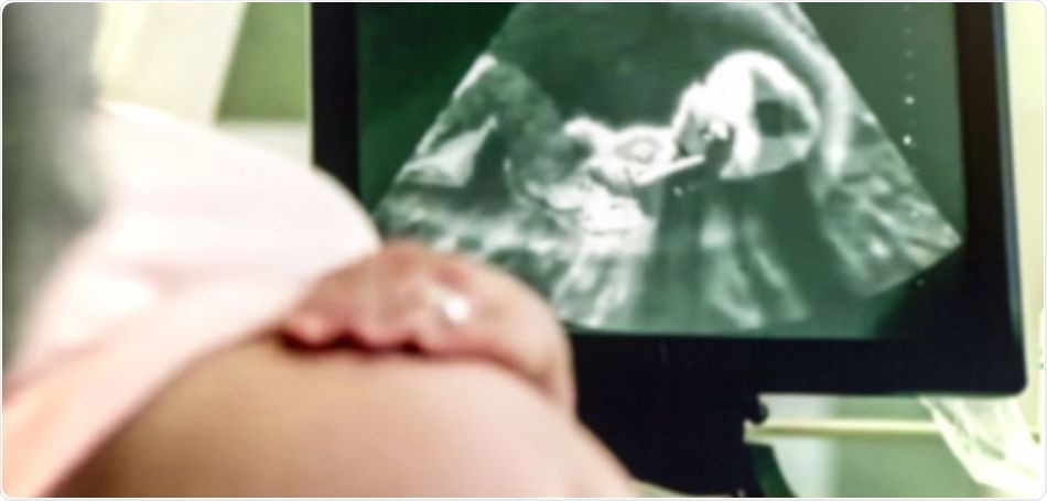 International study to evaluate the effects of COVID-19 in pregnancy launched