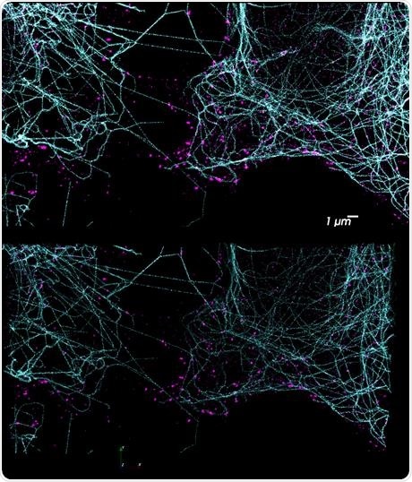 DNA PAINT has enormous potential for multiplexed imaging using the Vutara and its integrated fluidics unit. Using orthogonal docking strands on different probes, a potentially unlimited number of targets are possible. The top image shows a two-color DNA PAINT experiment performed on the Vutara 352 single-molecule localization microscope. Tubulin is labeled in cyan and clathrin in magenta. Due to the unbleachable nature of DNA PAINT, large Z-stacks are possible (bottom).