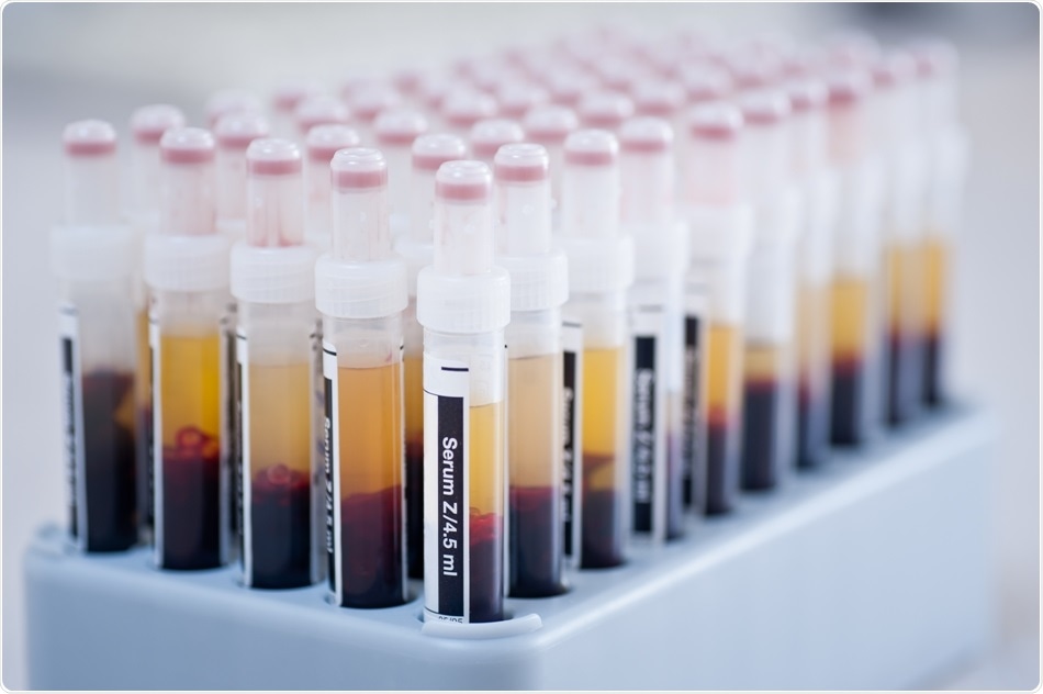 Tissue Solutions and CBSB join forces to increase COVID-19 sample availability