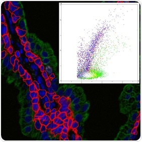 TissueGnostics joins the global fight gainst infectious diseases with our globalalliance against pandemic virus threats campaign