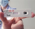 How do Coronavirus Antibody Tests Work?