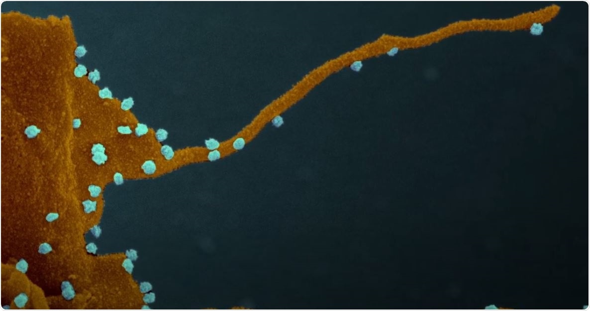 Coronavirus forces cells to produce tentacle-like structures that infect neighboring cells