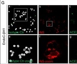 High ACE2 Expression on pancreatic islet cells during inflammation could explain new-onset diabetes in COVID-19