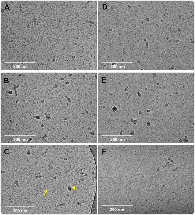 Effect of SARS-CoV-2 ectodomain spike sample storage on cryo-EM specimen preparation. (A-C) Representative cryo-EM micrographs of a SARS-CoV-2 S ectodomain sample that was flash frozen immediately after purification and stored in -80 °C, then thawed rapidly and incubated for ~ 5 min at 37 °C immediately prior to grid preparation. Cryo-EM images are low contrast, and the desired spike particles appear as medium gray spots (e.g. arrow) on a light gray background. Dark gray or black spots are slight ice contamination (e.g arrowhead). These panels on the left show an excellent distribution of discrete spike particles. (D-F) Representative cryo-EM micrographs of SARS-CoV-2 S ectodomain samples that were stored for ~1 week at 4 °C prior to grid preparation. Compared to the panels of the left, these panels on the right show a sparse field-of-view with very few intact spike particles visible. A similar spike concentration (~1 mg/ml) was used to freeze all the samples. Micrographs were collected on a Titan Krios microscope with a Gatan K3 camera.
