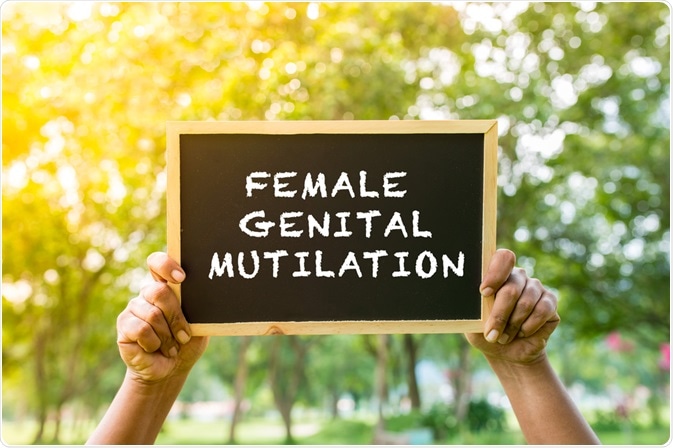 FGM