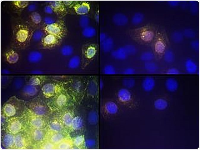 Image showing the effect of AR-12 on SARS-CoV-2 virus replication  CREDIT VCU Massey Cancer Center
